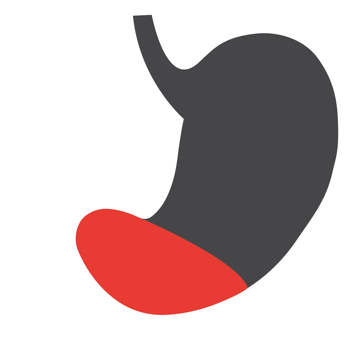 Gastrite antrale:  le cause, i sintomi, la cura 